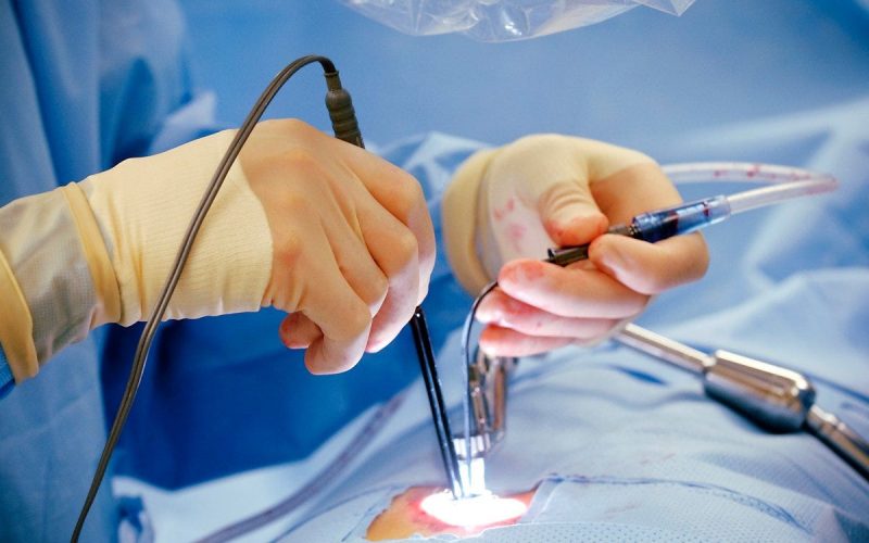 Laser Surgery